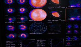CEDIMAT realiza gammagrafía cardíaca con Regadenoson